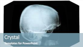  Presentation with skull - Slide deck having mandibe - x-ray picture of skull background and a teal colored foreground