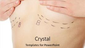  Presentation with cosmetic surgery - Theme having caucasian woman's abdomen mark background and a lemonade colored foreground
