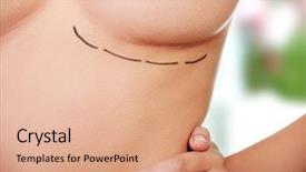  Presentation with breast surgery - Colorful PPT layouts enhanced with marked out for cosmetic surgery backdrop and a coral colored foreground