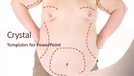  Presentation with cosmetic surgery - Audience pleasing theme consisting of marked with lines for abdominal backdrop and a lemonade colored foreground