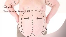  Presentation with cosmetic surgery - Amazing PPT layouts having marked with lines for abdominal backdrop and a lemonade colored foreground
