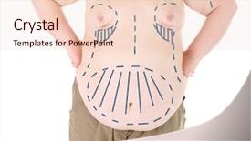  Presentation with cosmetic surgery - Colorful presentation design enhanced with marked with lines for abdominal backdrop and a lemonade colored foreground
