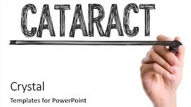 Presentation with eye cataract - PPT theme enhanced with marker writing the word cataract background and a white colored foreground