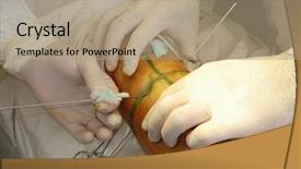  Presentation with needles - Cool new slide set with suture medical - surgeons and patient's leg moment backdrop and a coral colored foreground