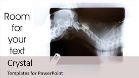  Presentation with broken heart - PPT theme consisting of medical broken heart - x-rays of a small dog background and a light gray colored foreground