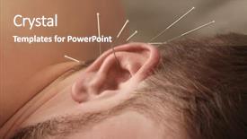  Presentation with acupuncture - Audience pleasing slide deck consisting of acupunture - young man getting acupuncture treatment backdrop and a coral colored foreground