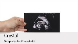  Presentation with baby medical - Audience pleasing presentation theme consisting of medical embryo - female hand with ultrasound picture backdrop and a light gray colored foreground