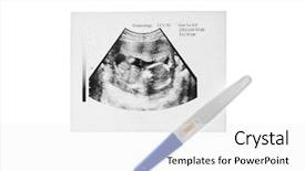  Presentation with medical embryo - Slide set with medical embryo - ultrasound picture of baby background and a white colored foreground