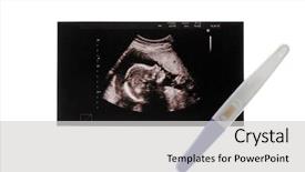  Presentation with baby medical - Audience pleasing slide set consisting of medical embryo - ultrasound picture of baby backdrop and a light gray colored foreground