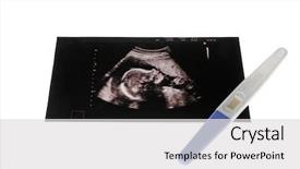  Presentation with medical ultrasound - Beautiful slide deck featuring medical embryo - ultrasound picture of baby backdrop and a light gray colored foreground