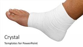  Presentation with gold food white - PPT layouts consisting of medical feet - bandaged foot on a white background and a white colored foreground