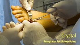  Presentation with surgery - Presentation design having medical feet - foot surgery background and a tawny brown colored foreground