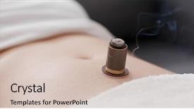  Presentation with woman in under wear - Colorful slides enhanced with medical fire - woman undergo moxibustion therapy backdrop and a soft green colored foreground