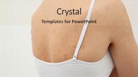  Presentation with allergy - PPT layouts enhanced with medical gall - allergy concept young woman background and a lemonade colored foreground