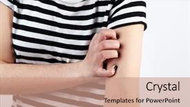  Presentation with close up of bark - Presentation design having medical gall - woman has itch close up background and a coral colored foreground