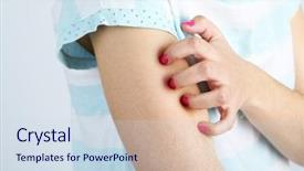  Presentation with pastel pink and gray - Colorful theme enhanced with medical gall - woman has itch on gray backdrop and a sky blue colored foreground