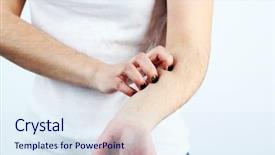  Presentation with solid gray - Beautiful presentation design featuring medical gall - woman has itch on gray backdrop and a sky blue colored foreground