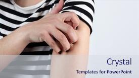  Presentation with pastel pink and gray - Audience pleasing PPT theme consisting of medical gall - woman has itch on gray backdrop and a sky blue colored foreground