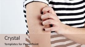  Presentation with gray - Slide set with medical gall - woman has itch on gray background and a coral colored foreground