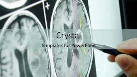  Presentation with medical - Beautiful presentation theme featuring medical graph on screen backdrop and a mint green colored foreground