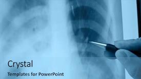  Presentation with analyzing behavior - Audience pleasing presentation theme consisting of medical graphs - analyzing x-ray picture on screen backdrop and a  colored foreground