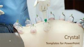  Presentation with medical therapy - PPT theme having medical hijama cupping therapy background and a soft green colored foreground