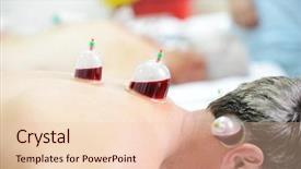  Presentation with medical therapy - Amazing theme having medical hijama cupping therapy backdrop and a lemonade colored foreground