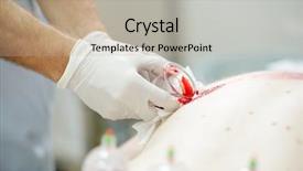  Presentation with medical therapy - Slide deck consisting of medical hijama cupping therapy background and a mint green colored foreground