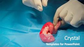  Presentation with surgery room - Audience pleasing theme consisting of medical intestinal - veterinarian is operating an cat backdrop and a teal colored foreground
