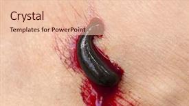  Presentation with parasite - Presentation having medical parasite - blood sucking leech leech sucking background and a lemonade colored foreground