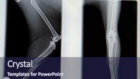  Presentation with broken leg - Beautiful PPT theme featuring autumn day in canadian rockies red deer with branched antlers standing on a rocky shoal creek backdrop and a gray colored foreground