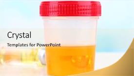  Presentation with urine - Colorful slide set enhanced with medical urine test close-up backdrop and a yellow colored foreground
