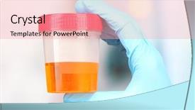 Presentation with urine - Theme enhanced with medical urine test close-up background and a lemonade colored foreground