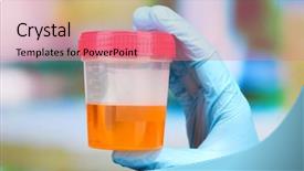  Presentation with urine - Audience pleasing slide set consisting of medical urine test close-up backdrop and a coral colored foreground