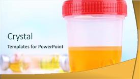 Presentation with urine - Beautiful PPT layouts featuring medical urine test close-up backdrop and a sky blue colored foreground