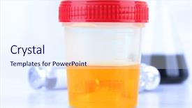  Presentation with urine - PPT theme with medical urine test close-up background and a sky blue colored foreground