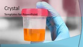  Presentation with kidney medical - Audience pleasing PPT theme consisting of medical urine test close-up backdrop and a coral colored foreground