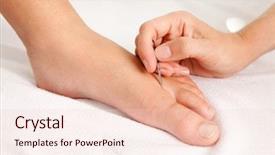  Presentation with acupuncture - PPT theme having medicin alternativ - detail of a shonishin acupuncture background and a lemonade colored foreground