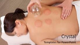  Presentation with acupuncture - PPT layouts consisting of medicine cup - back detail of a young background and a coral colored foreground