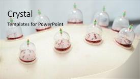  Presentation with medical therapy - Theme featuring packages delivery concept toy car background and a lemonade colored foreground