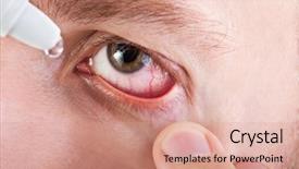  Presentation with eye medicine - PPT theme featuring medicine healthcare liquid eyedropper background and a coral colored foreground