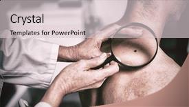  Presentation with melanoma - PPT layouts consisting of melanoma - dermatologist examining mole with magnifying background and a lemonade colored foreground