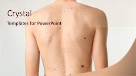  Presentation with young man on the phone - Cool new PPT theme with melanoma - young man with birthmarks backdrop and a lemonade colored foreground