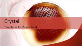  Presentation with meningitis - Presentation theme with meningitis - hand in glove holding petri background and a red colored foreground