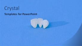  Presentation with ceramic - Cool new slide deck with metal-free-ceramic-dental-crowns backdrop and a light blue colored foreground