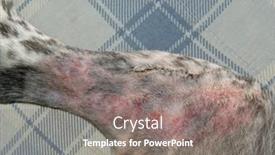  Presentation with skin surgery - PPT theme consisting of metal-staples-on-the-inside background and a gray colored foreground