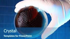  Presentation with bacteria - Presentation having micro organisme - hand in glove holding petri background and a ocean colored foreground