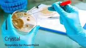  Presentation with microbial plate - Slide deck with microbial testing - germs growing on an agar background and a cyan colored foreground