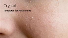  Presentation with plural - Beautiful slide deck featuring milium plural milia on face backdrop and a coral colored foreground