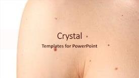  Presentation with light - Beautiful PPT layouts featuring mofle - young man with birthmarks backdrop and a lemonade colored foreground